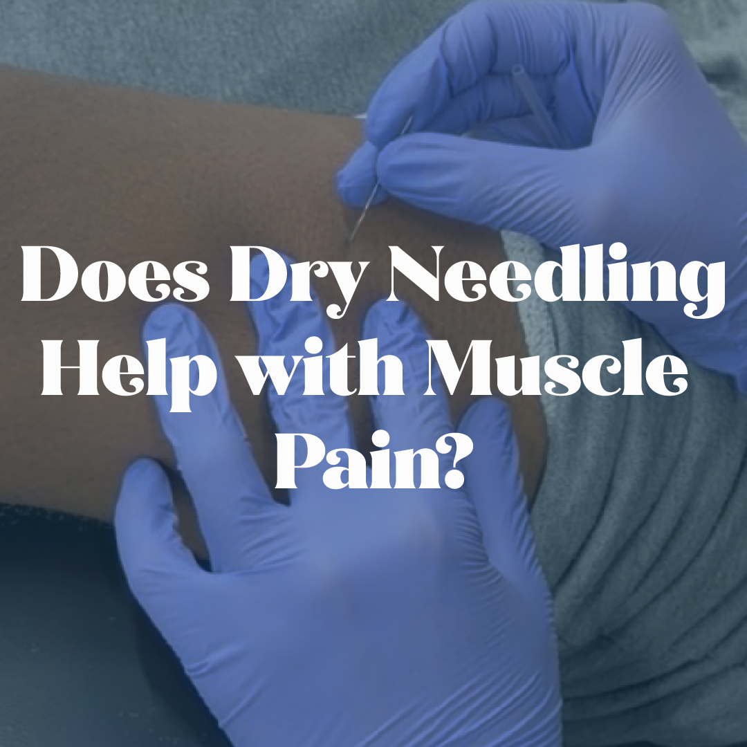 does dry needling help with muscle pain